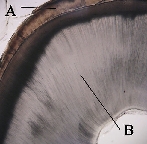 File:Crosssectiontooth11-24-05.jpg