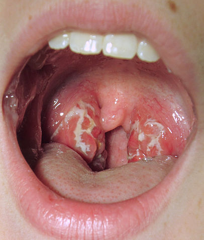 File:Pos strep.JPG