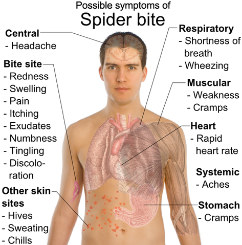 File:Symptoms of Spider bite.png
