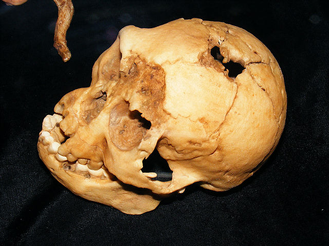 File:LB1 skull.jpg