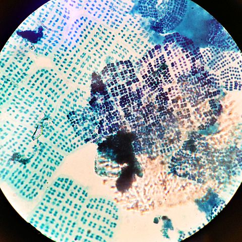 File:Cyanobacteria Merismopedia.JPG