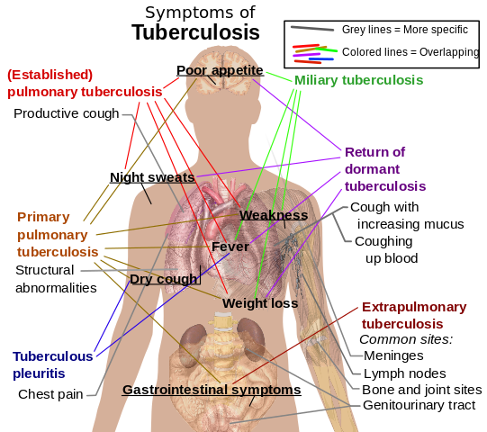 File:Tuberculosis symptoms.svg