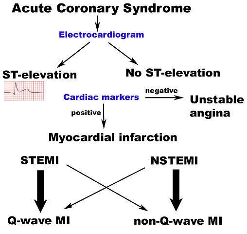 File:ACS scheme.jpg