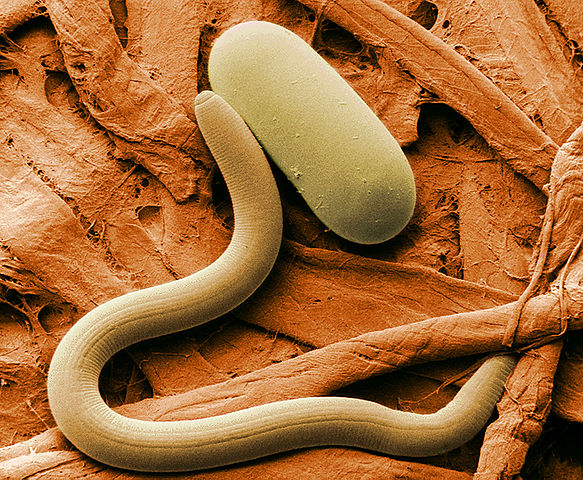 File:Soybean cyst nematode and egg SEM.jpg