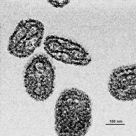 File:EM smallpox, grown via tissue, isolate by centrifuge.jpg